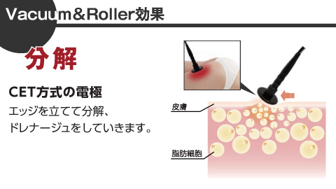 Vacuum&Roller効果:分解 CET方式の電極 エッジを立てて分解、ドレナージュをしていきます。