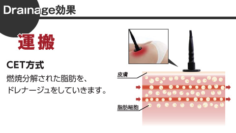 Drainage効果:運搬 CET方式 燃焼分解された脂肪を、ドレナージュをしていきます。